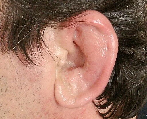 Homeopathic remedies for treating vertigo, sinusitis, and eye infections